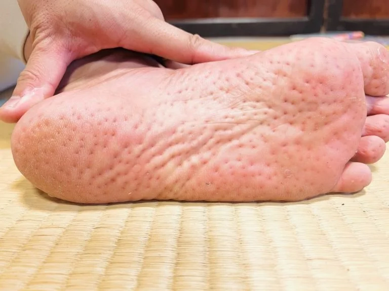 シャクティマットを足裏に使っている様子